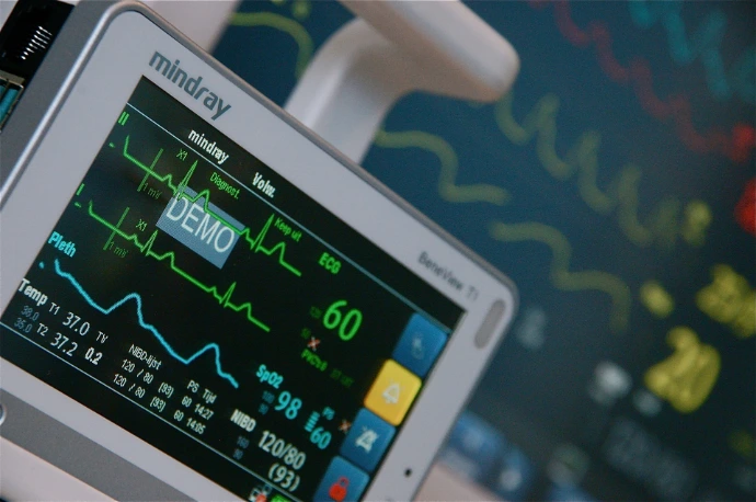 heart rate variability